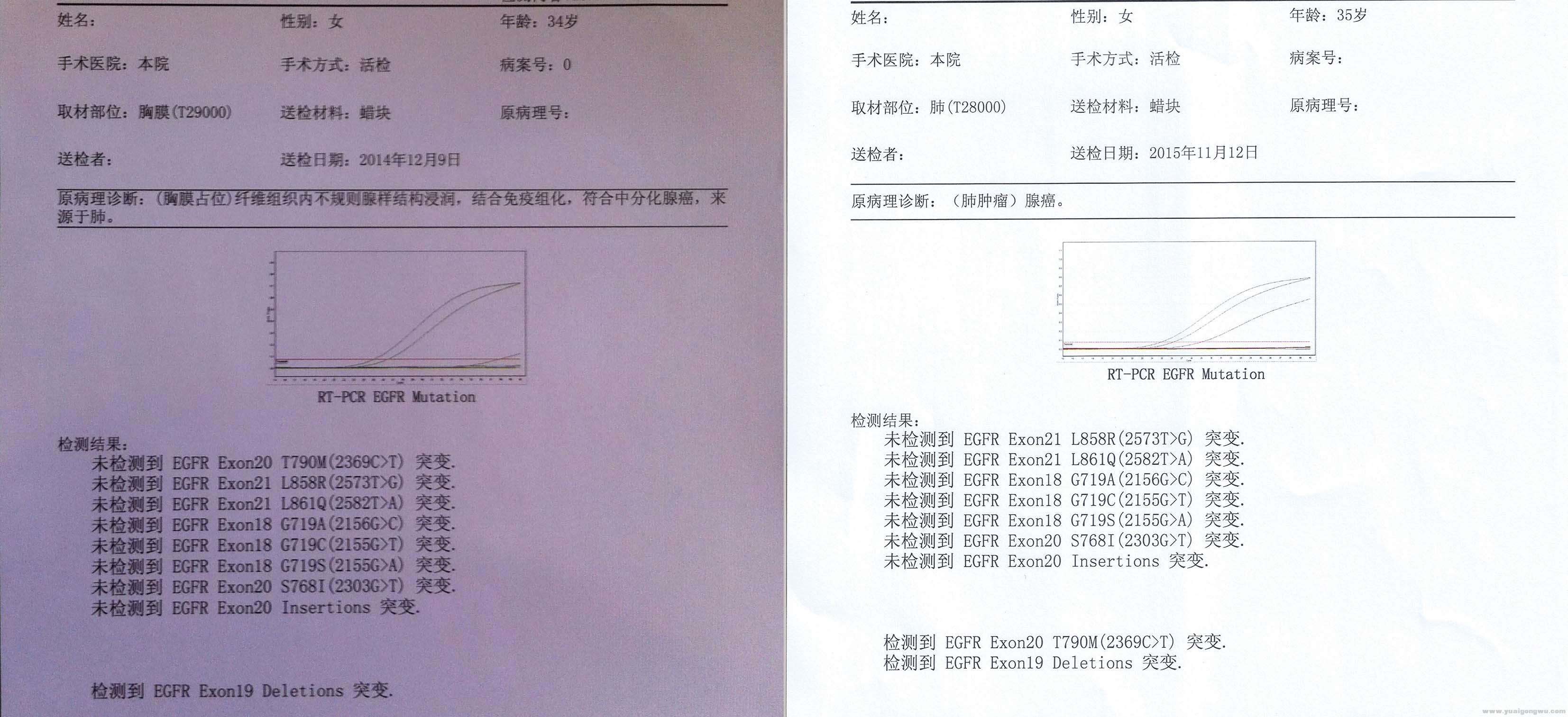 之前基因突变检测结果