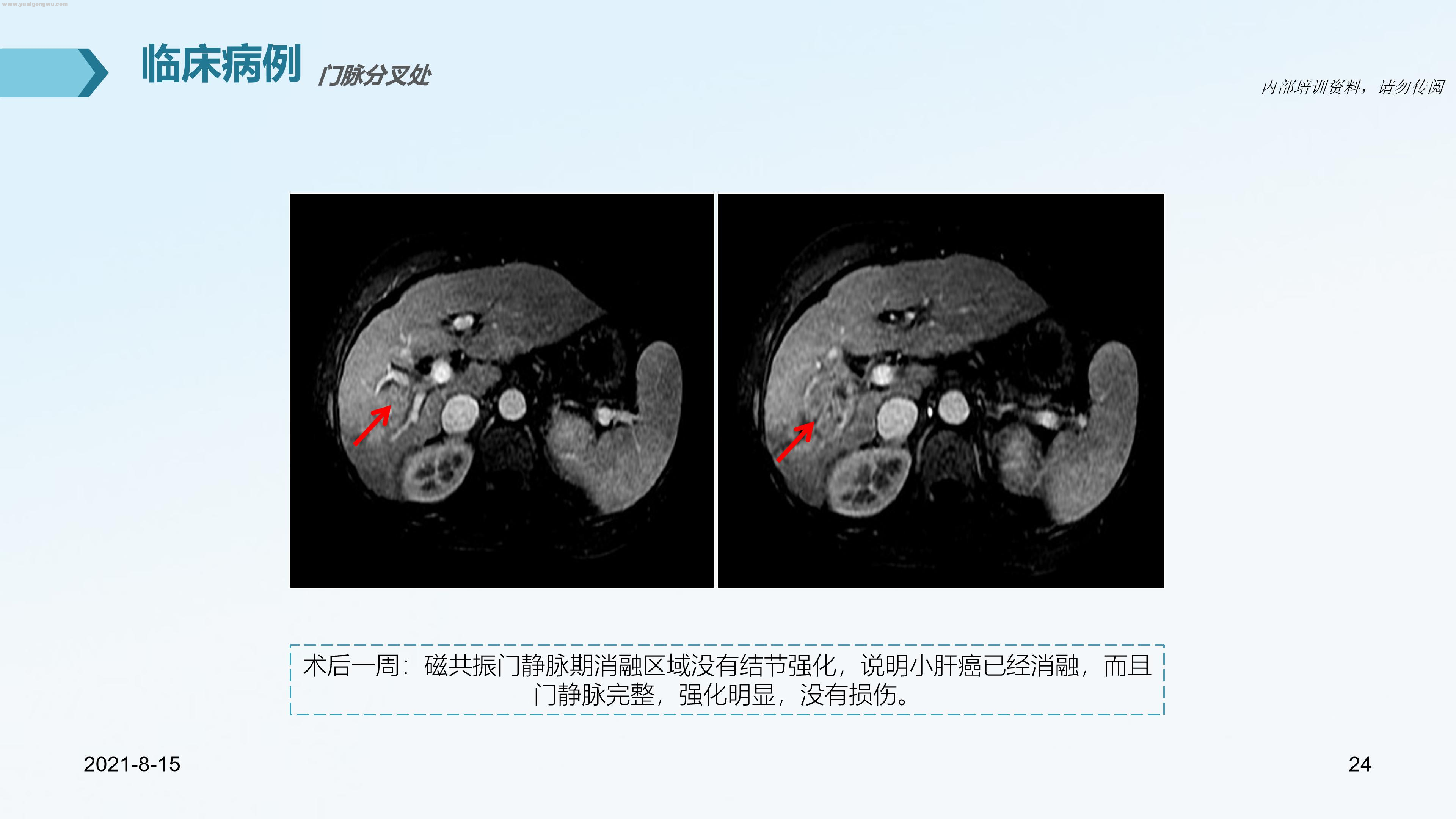 图片14.png