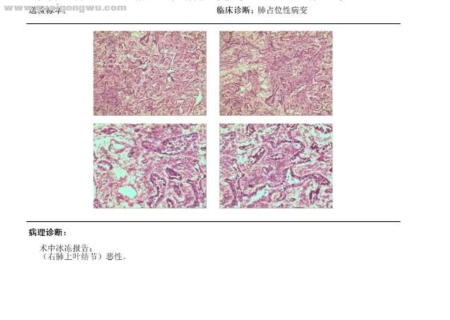 病理报告04